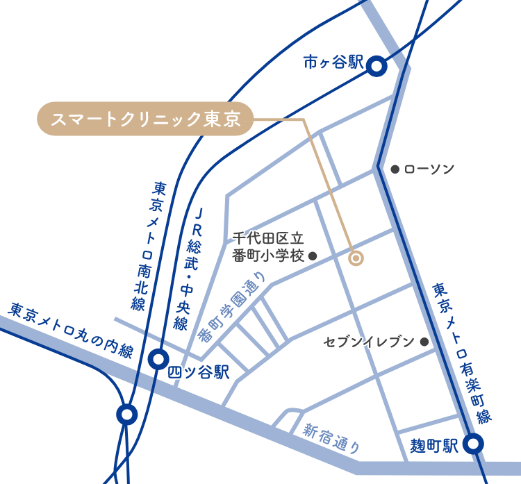 sp_access_map_pic