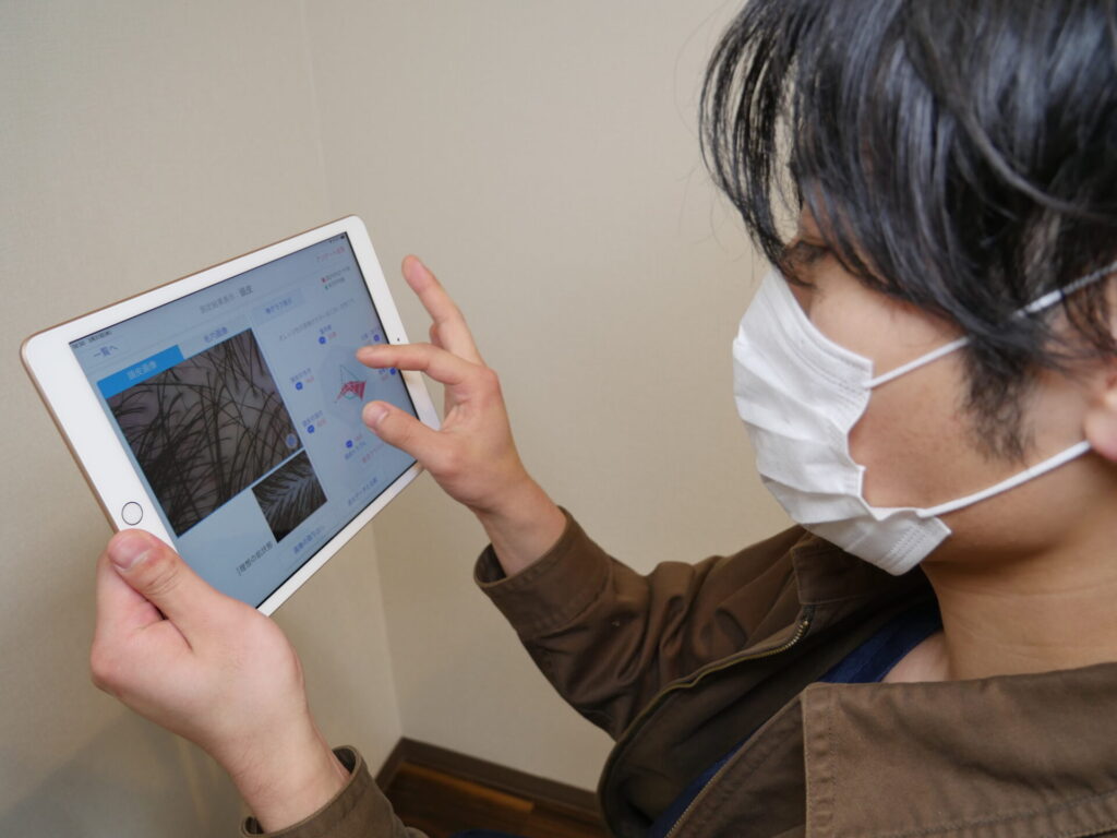 頭皮チェック
