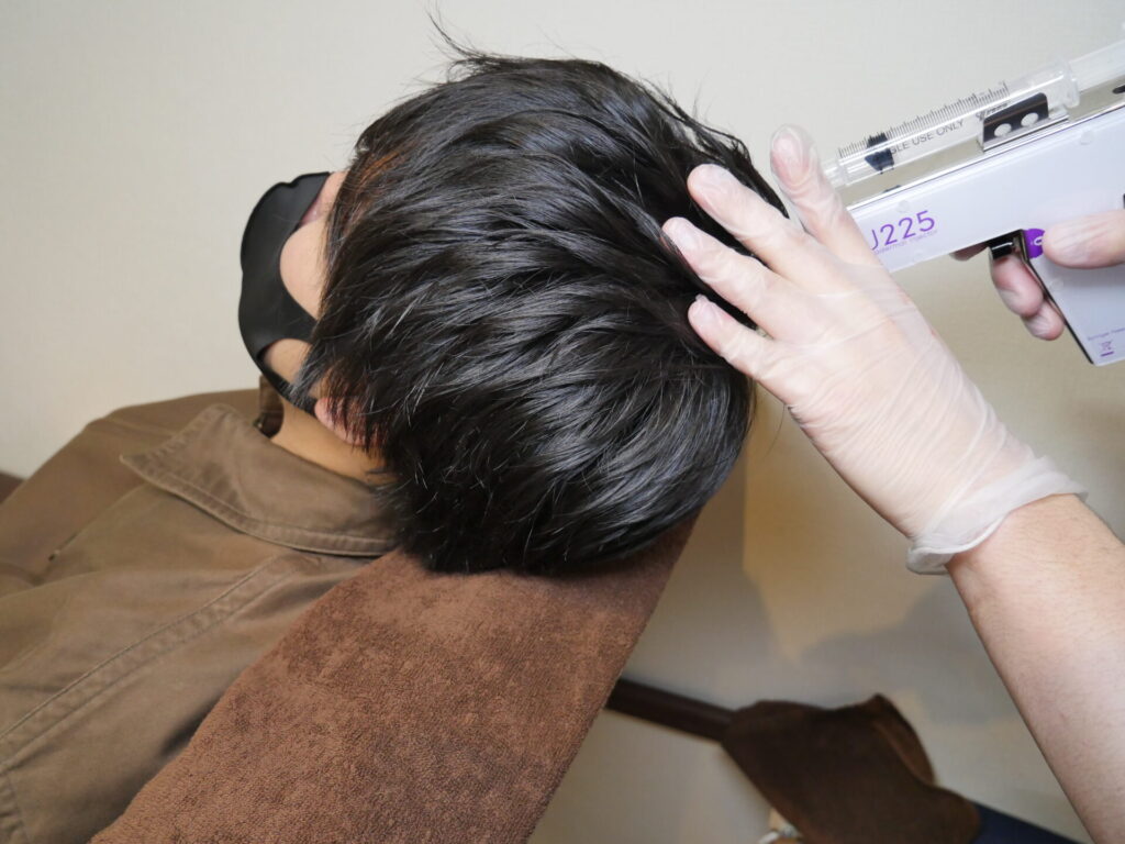 メソガン施術