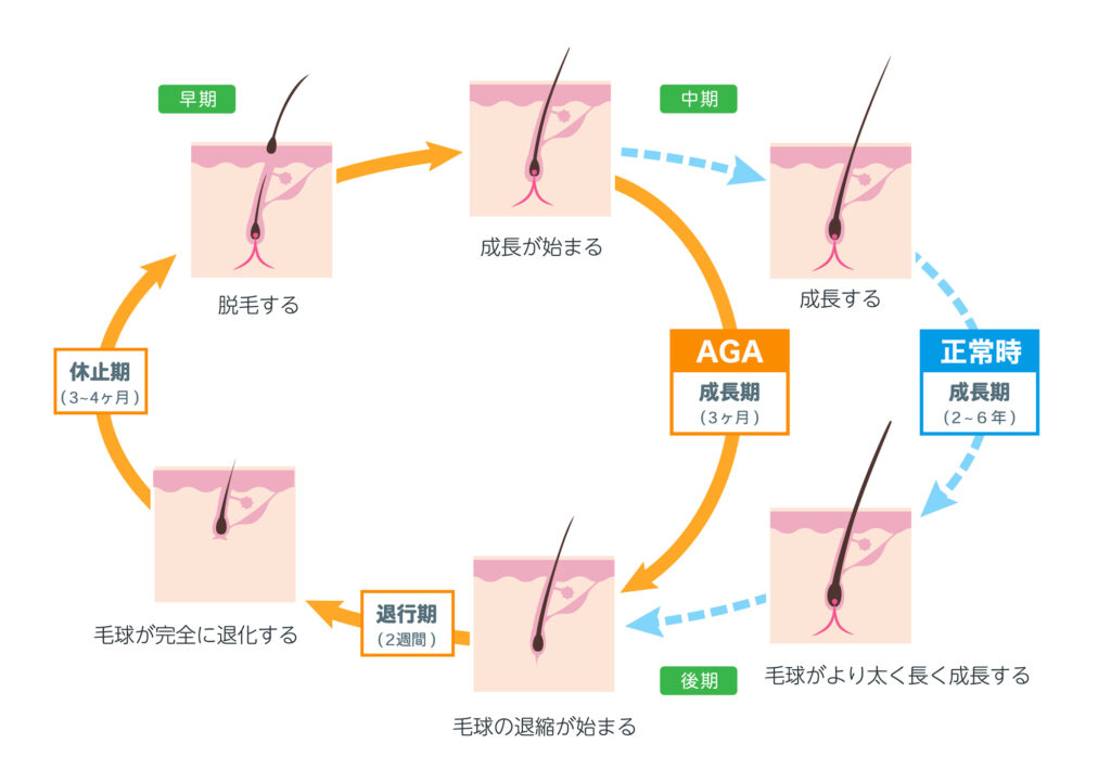 毛周期の乱れ